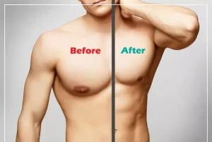 Treatment at Competitive Rates
